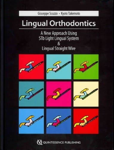 Lingual Orthodontics: A New Approach Using Stb Light Lingual System & Lingual Straight Wire 1st Edition