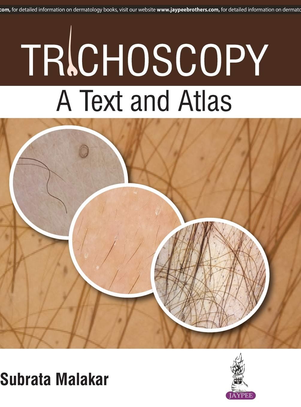 Trichoscopy: A Text and Atlas